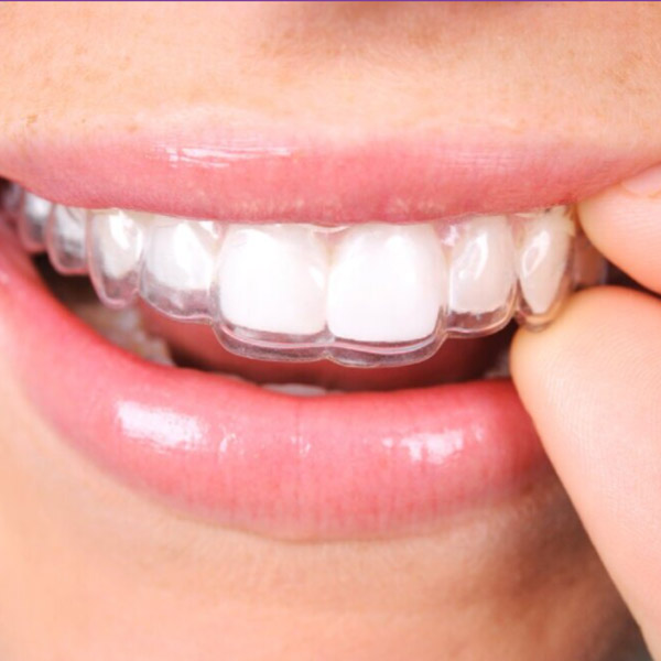 close up of person wearing invisalign